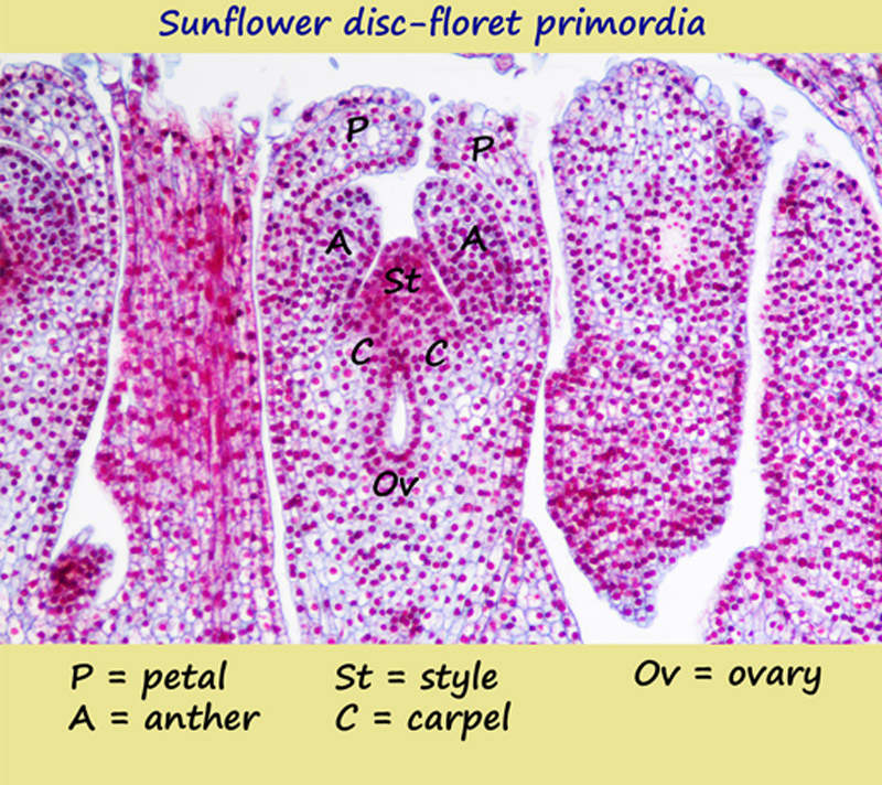 smaller-labelled-6micron-su.jpg