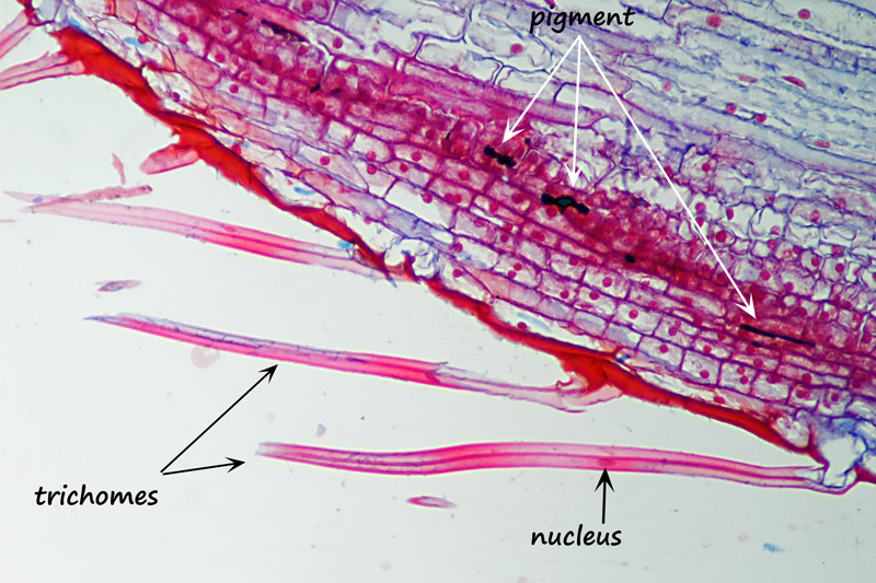 ws_sunflower-cypsela-tricho.jpg