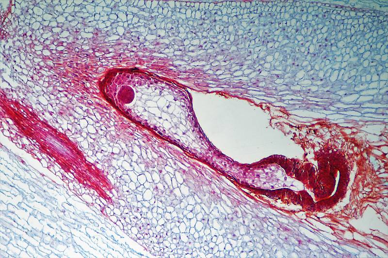 ws_sunflower early embryo (2).jpg