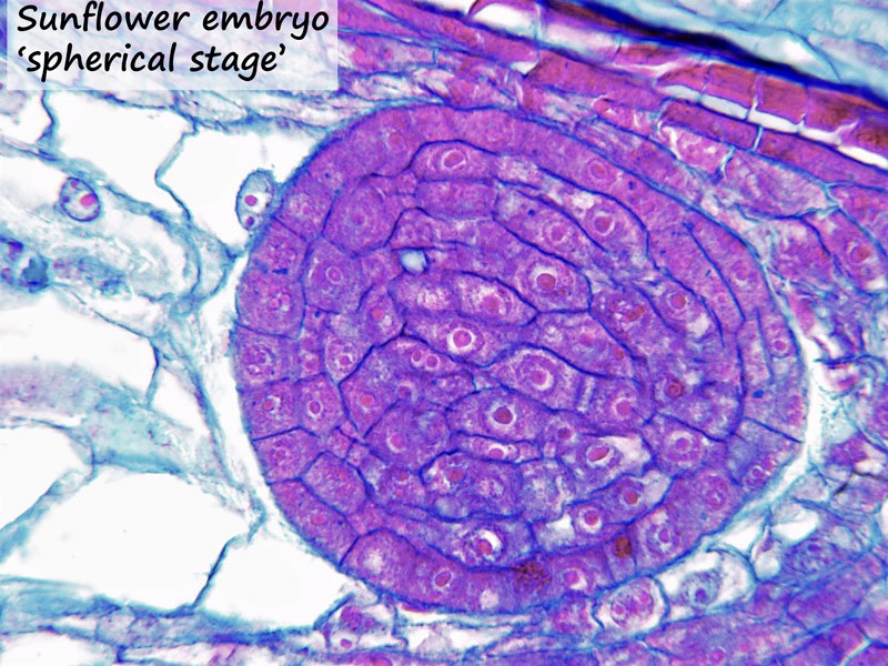 ws_embryo-spherical-stage-1.jpg