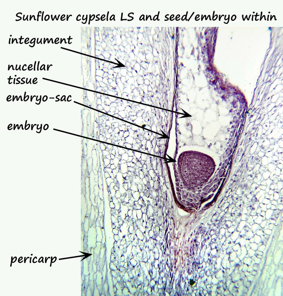 ws_labelled-embryo-in-sac.jpg