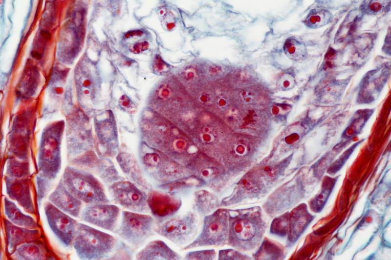 ws_helianthus embryo sac (12).jpg