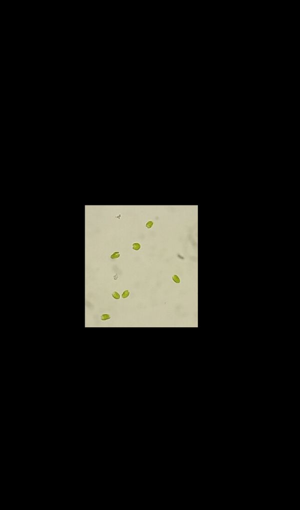 Phytoplankton Dil. gelatine.jpg