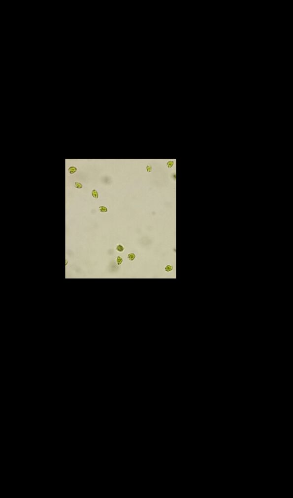 Phytoplanktom Conc. gelatine.jpg