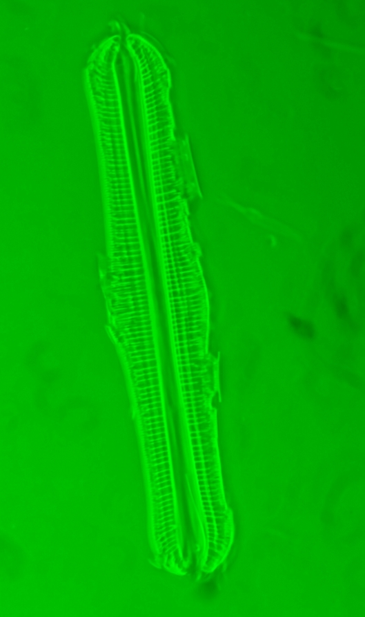 Diatom D - 63x 1.4NA Phase3 oil immersion.jpg