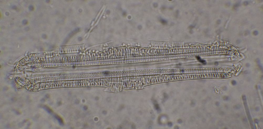 Diatom D - Brightfield.jpg