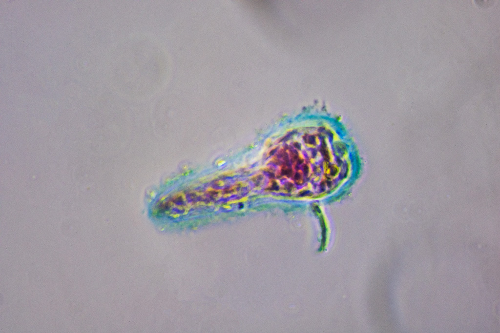 Liver fluke larva; Fasciola hepatica. 40/0.64, Phase Contrast, Nikon d810, Photoshop CC