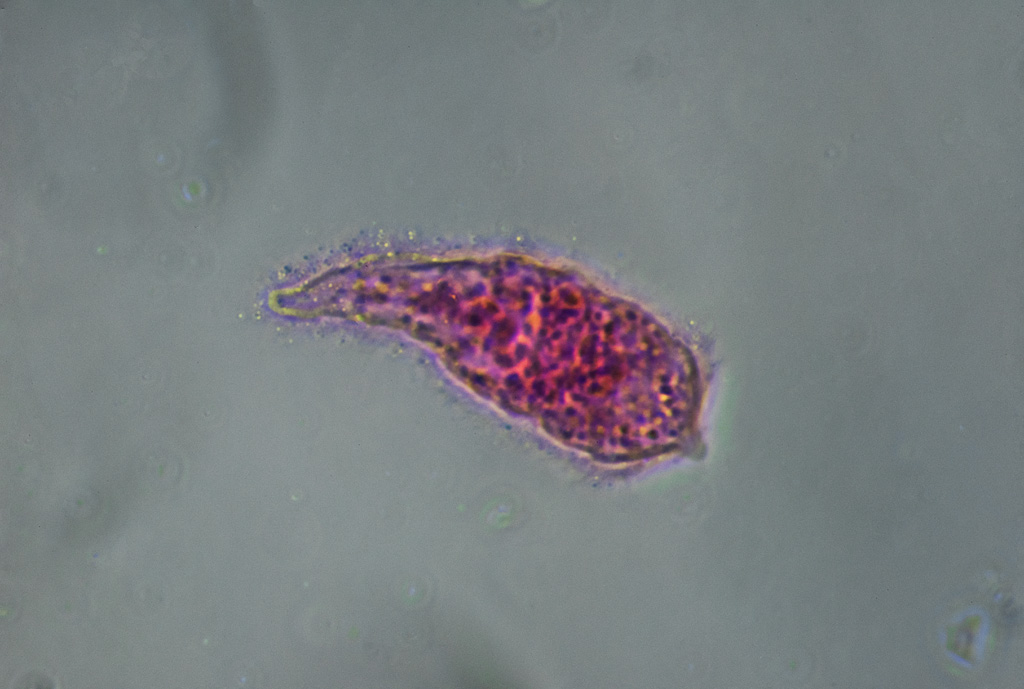 Blood fluke larva; Schistosoma mansoni. 5 image focal stack, 40/0.64, Phase Contrast, Nikon d810, Photoshop CC