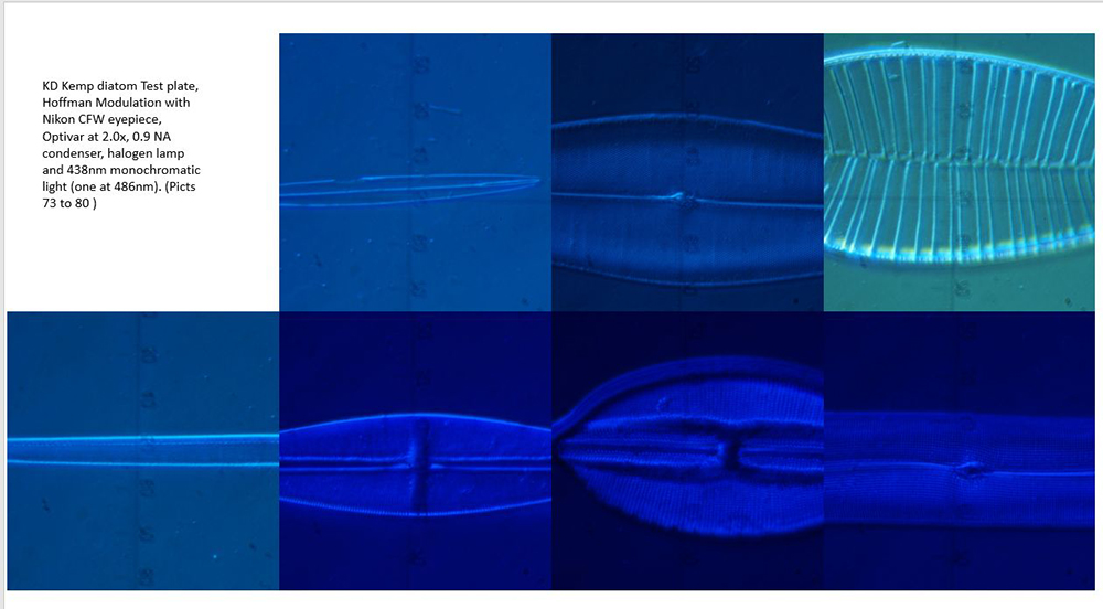 Hoffman Modulation 40X, Optovar 2.0X, with 438 monochromatic light