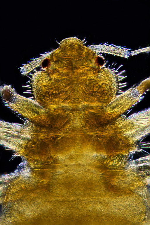 Gus the bedbug; 4x / .1, Dark-Field Lighting, Eight Image Focus Stack, Nikon d810, Photoshop CC