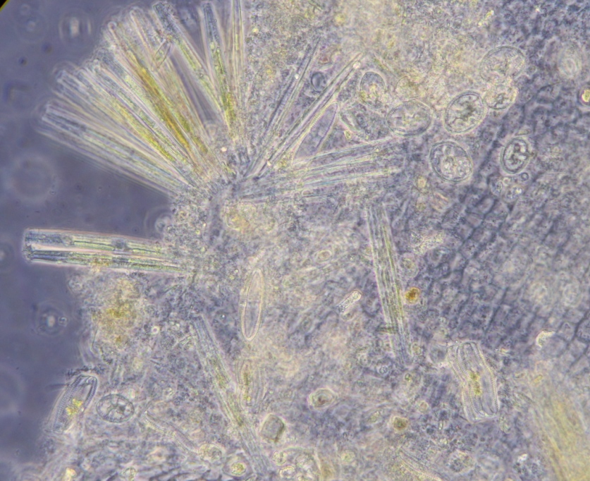 Diatom clusters near alga.jpg