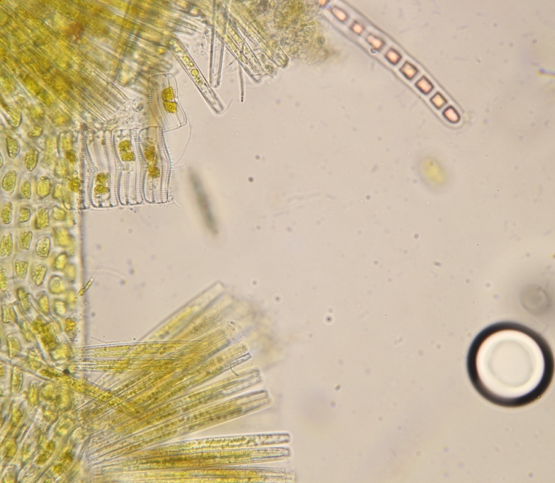 Diatoms near alga.jpg