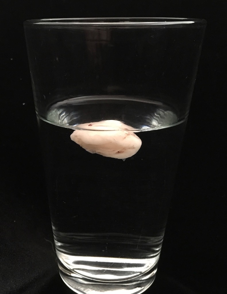 Fatty mass floating in a glass of water.