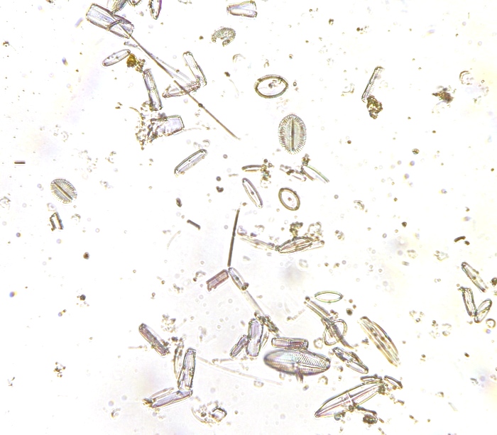 marine diatoms 40x~0.7 oil air 4jpg.jpg