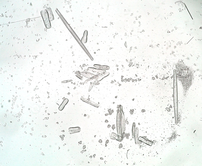 marine diatoms 40x~0.7 oil air brightfield.jpg