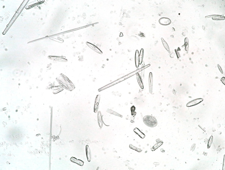 marine diatoms 40x~0.7 oil air brightfield_1.jpg