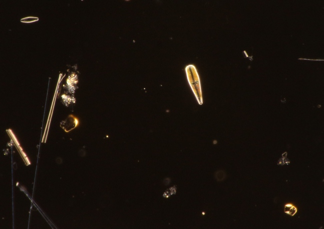 freshwater diatom 36micron, 40x~0.7 oil darkefield PS-CBO.jpg
