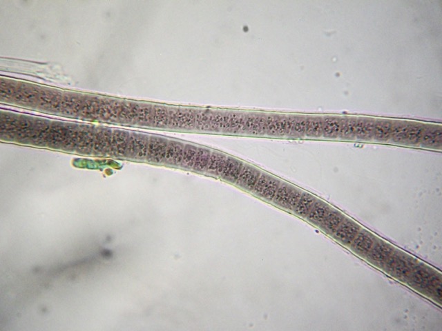 Close-up of cells type 1