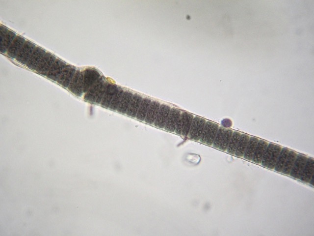 Close-up of cells type 2 with a unique &quot;bend&quot; found very rarely