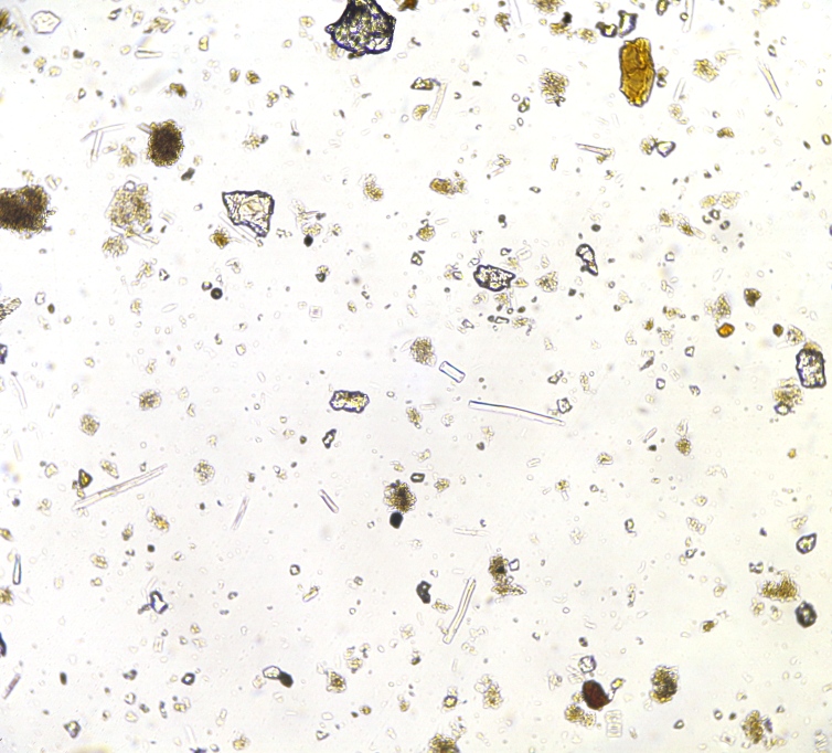 (4) Incinerated and cleaned EDTA+SDS then spread in DW. 10X Neofluar.JPG