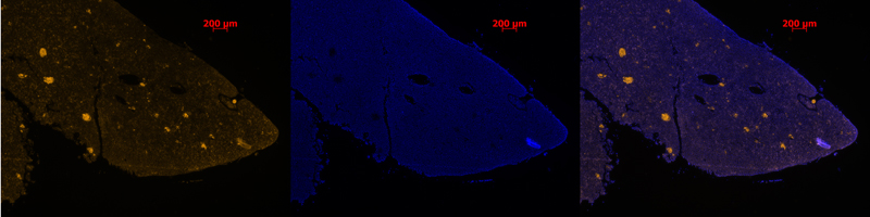 CC spleen 5x all in one small.jpg