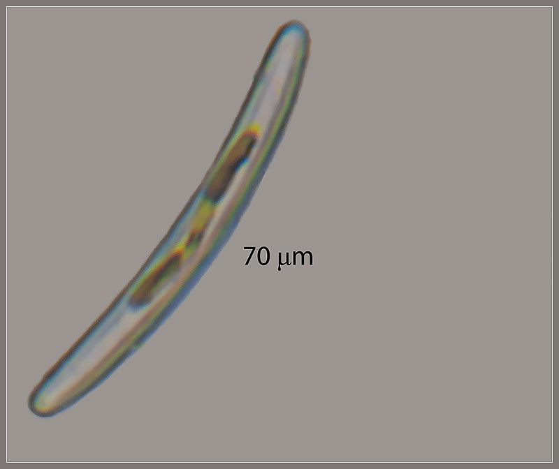 Diatom_GNZ20180729-0124.jpg