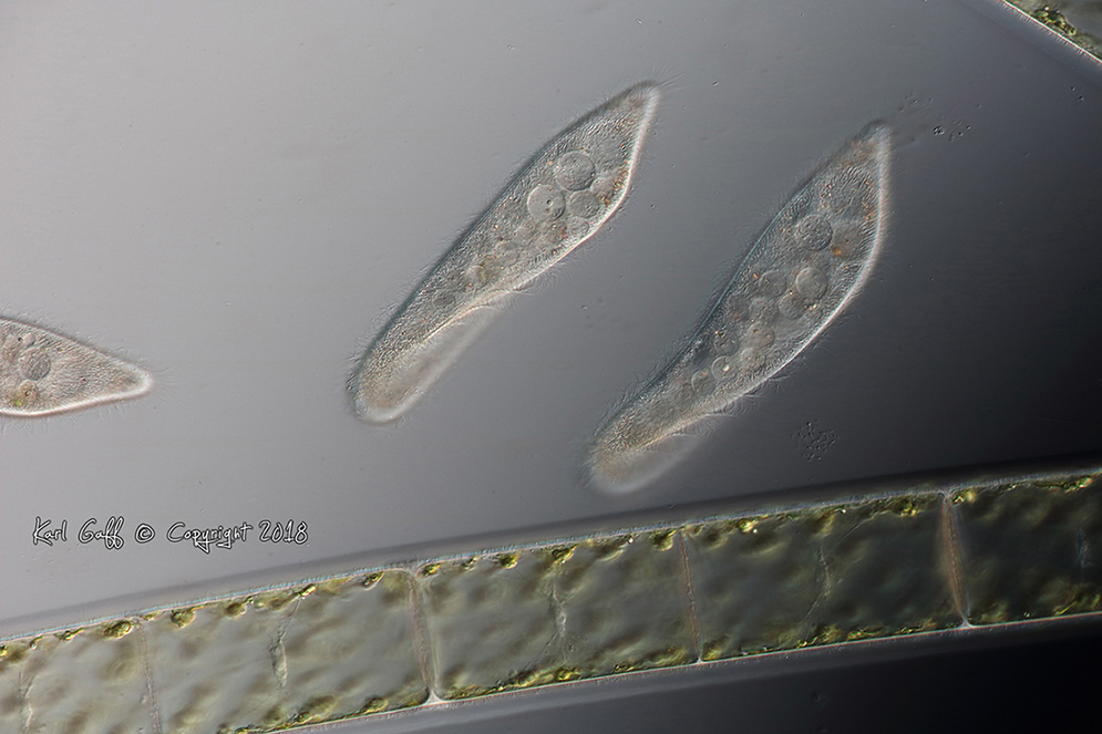 Paramecium feeding on the biofilm that encapsulates a strand of alga. The cell nuclei and cytoskeletal network is visible in the algal cells that form the filament. It is mind blowing to watch the motor proteins streaming along the dynamic filaments that make up the network.