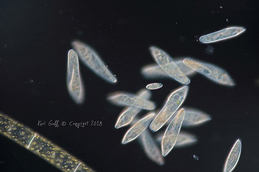 Paramecium formed small clusters in the vicinity of algal strands. This is one such cluster.