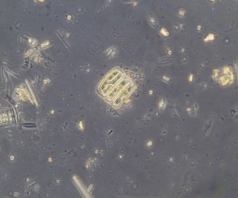 8 hours H2O2 RT. Medium diatoms still contain pigments(3).JPG