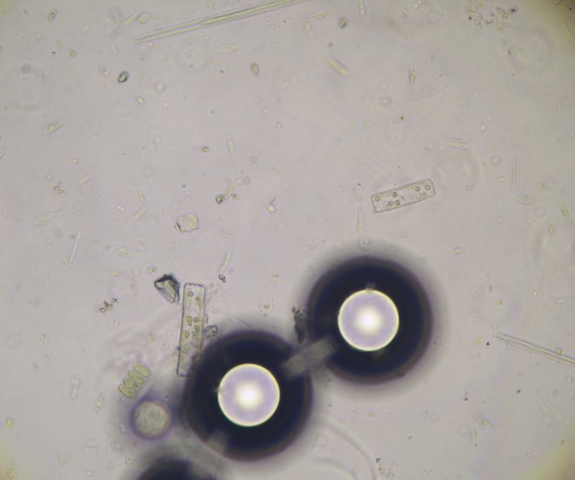 8 hours H2O2 RT. Medium diatoms still contain pigments(1).JPG