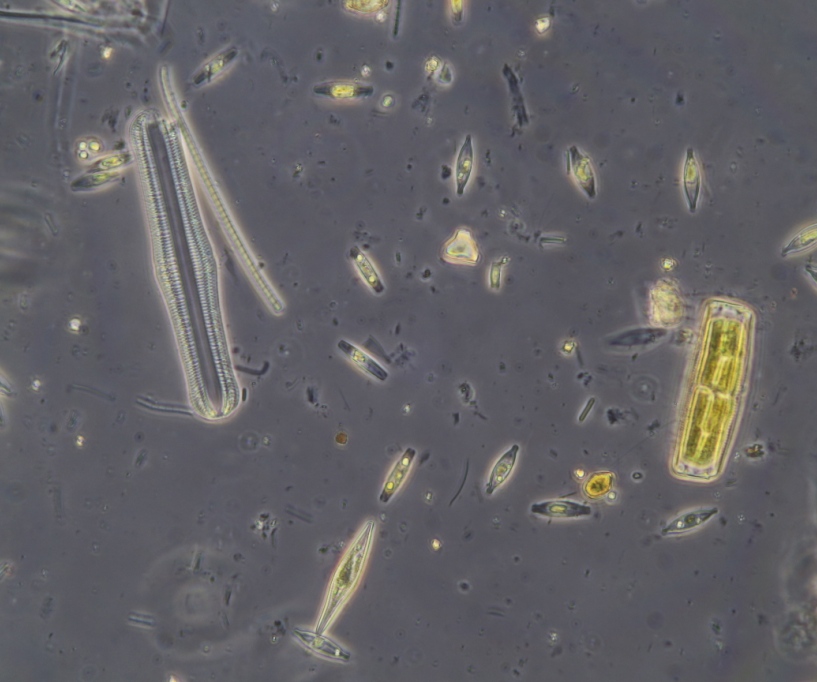 5 hours H2O2 RT. Most medium diatoms and tiny diatoms contain pigments (3).JPG