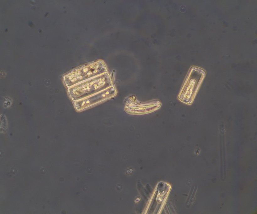 24 hours H2O2 RT. Diatoms still contain pigments(7).JPG