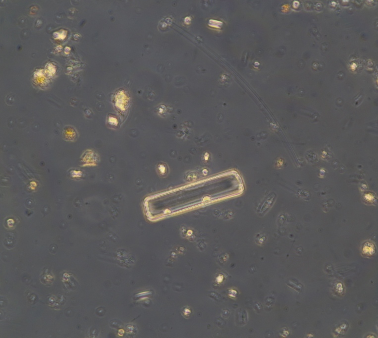 24 hours H2O2 RT then 1 hour boiling. Diatoms are mostly clean (8).JPG