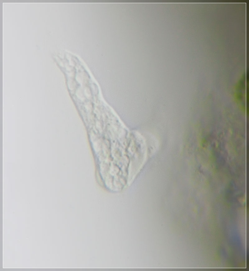 Amoebae phagocytosis 2.jpg
