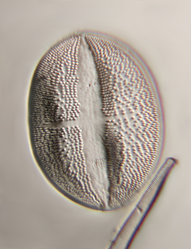 61µm, Stack of 5