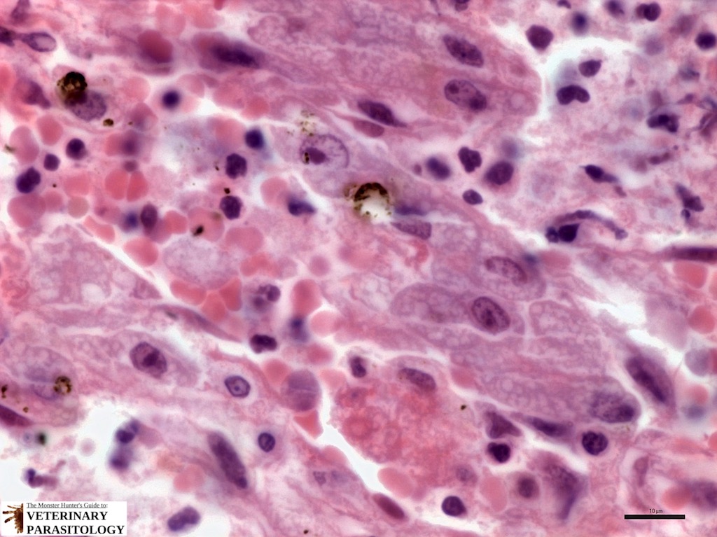 Entamoeba histolytica cross-section of liver abscess (3 stack) (Logo).jpg