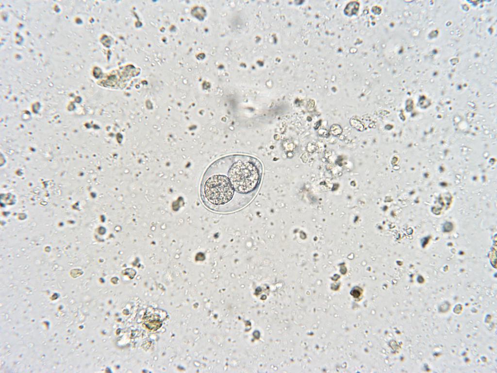 Cystoisospora felis (40X).jpg