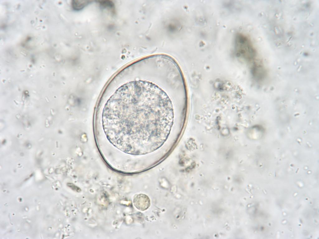 Cystoisospora felis (100x).jpg