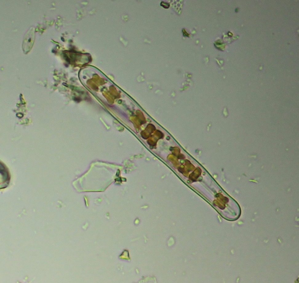 diatom_2.JPG