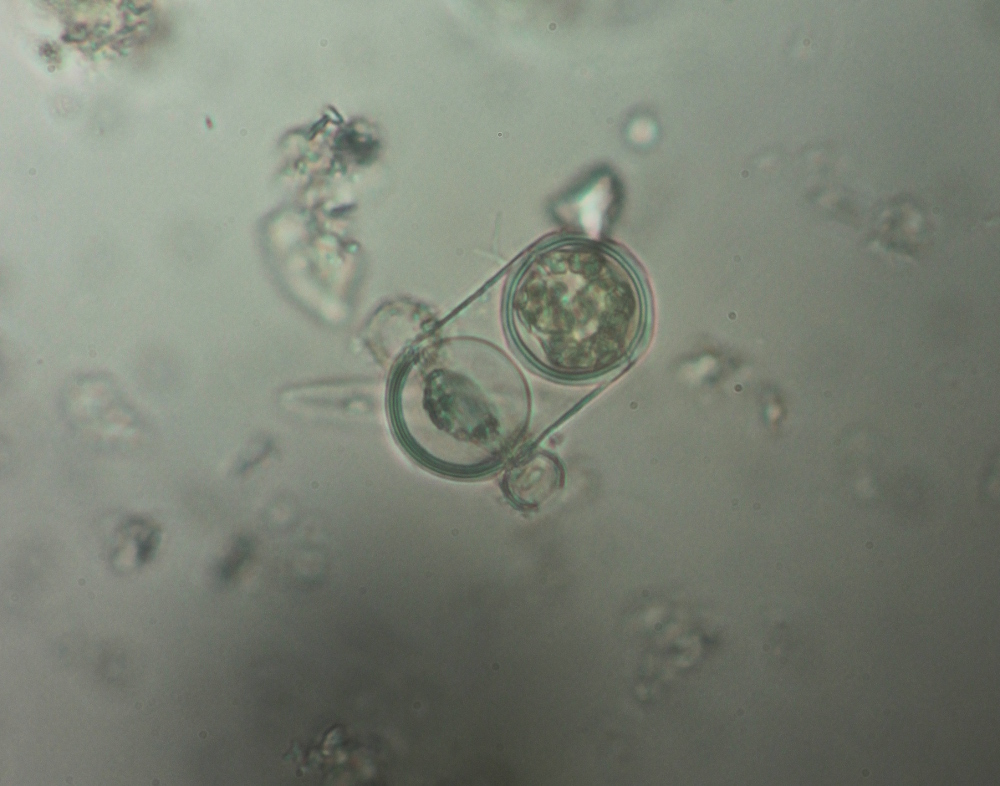 odd_diatom.JPG