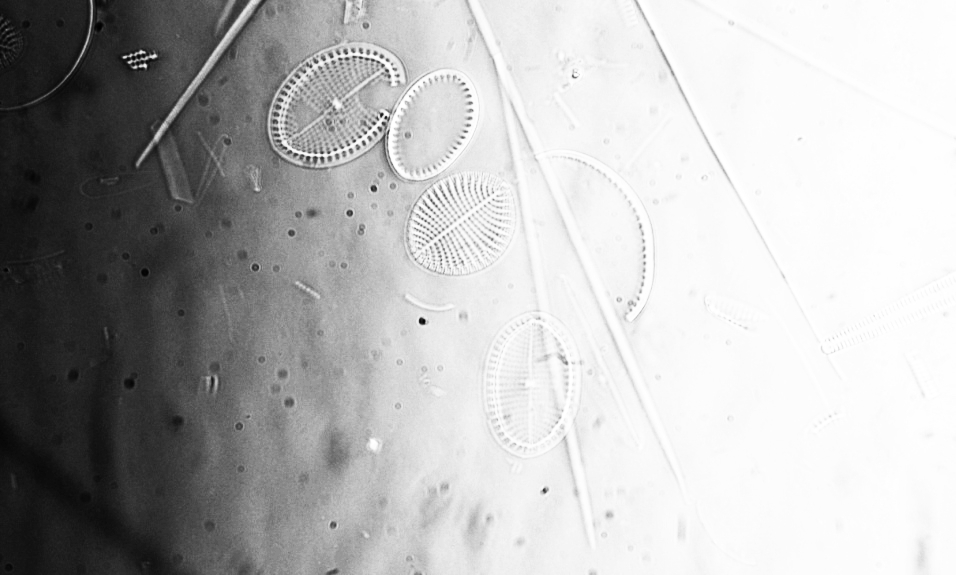 Dorons diatoms 1.jpg
