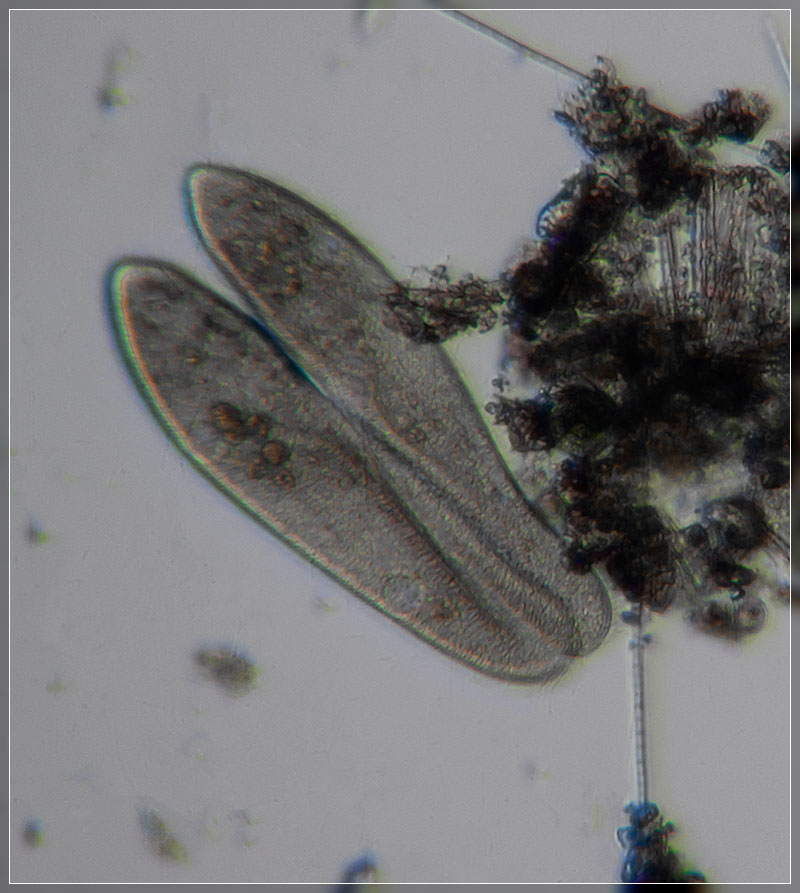 Paramecium-caudatum_GNZ20181101-03446.jpg