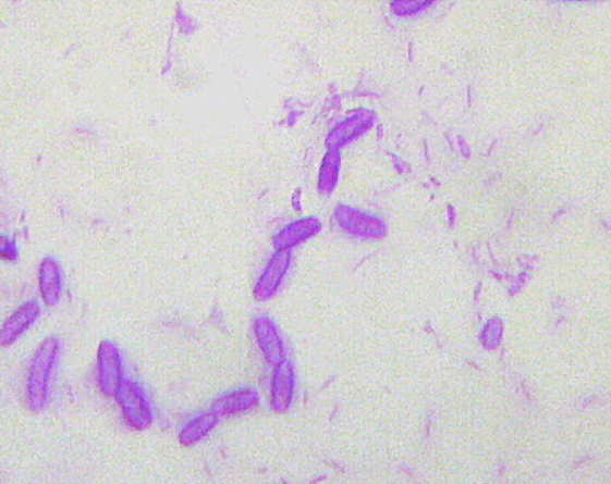 Large_bacilli2a.JPG