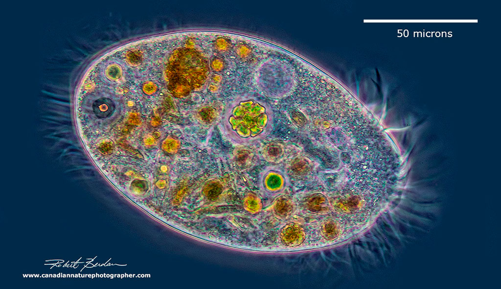 Ciliate - unidentified species Phase contrast