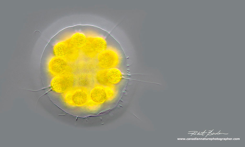 Eudorina DIC microscopy