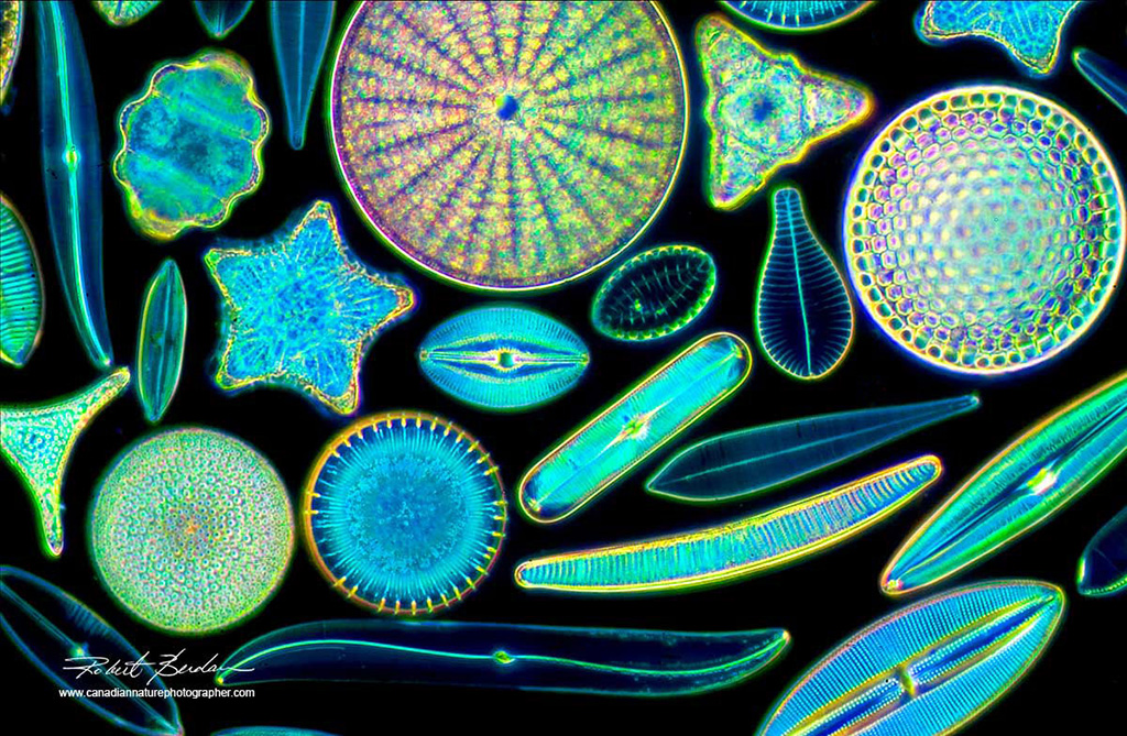 Prepared Diatoms Darkfield microscopy