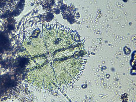 122418 algae 3sm.png