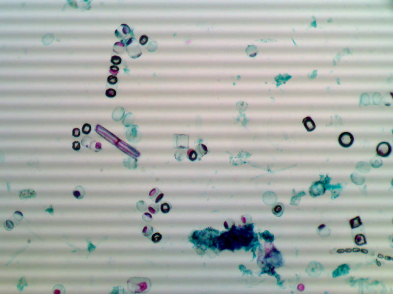 Diatoms_incandescent.jpg