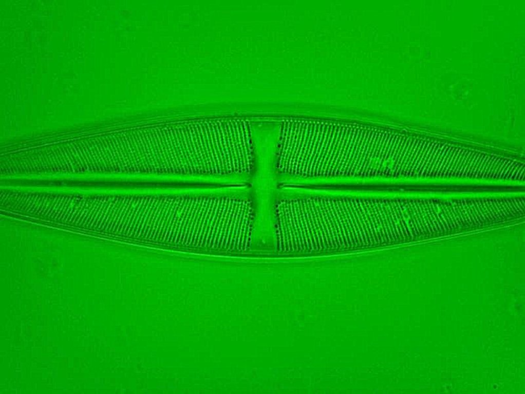 4- diatom unsharp mask ImageJ 2.0 pixel 0.8 mask weight.jpg