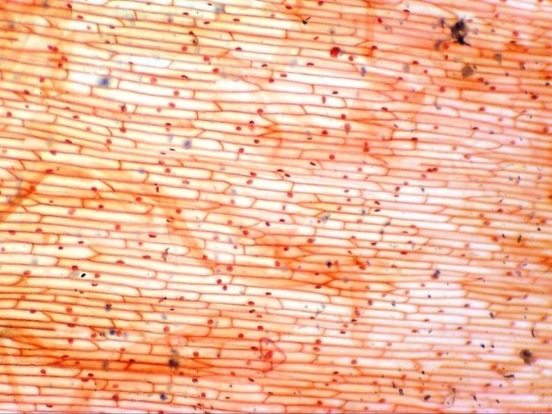 3) Trans illumin. onion skin stained with neutral red, 40X.jpg